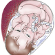 A full-term baby.
